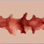Textura 03